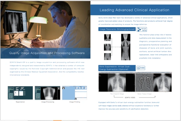 Yang Eva Portable X-Ray with inbuilt DR Systems - Portable